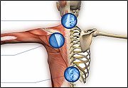 Conditions Treated Thumbnail A persons body showing muscular and skeletal frame works