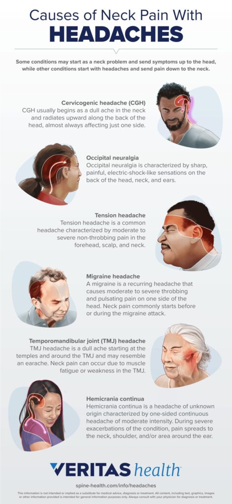 Causes of neck pain with headaches.